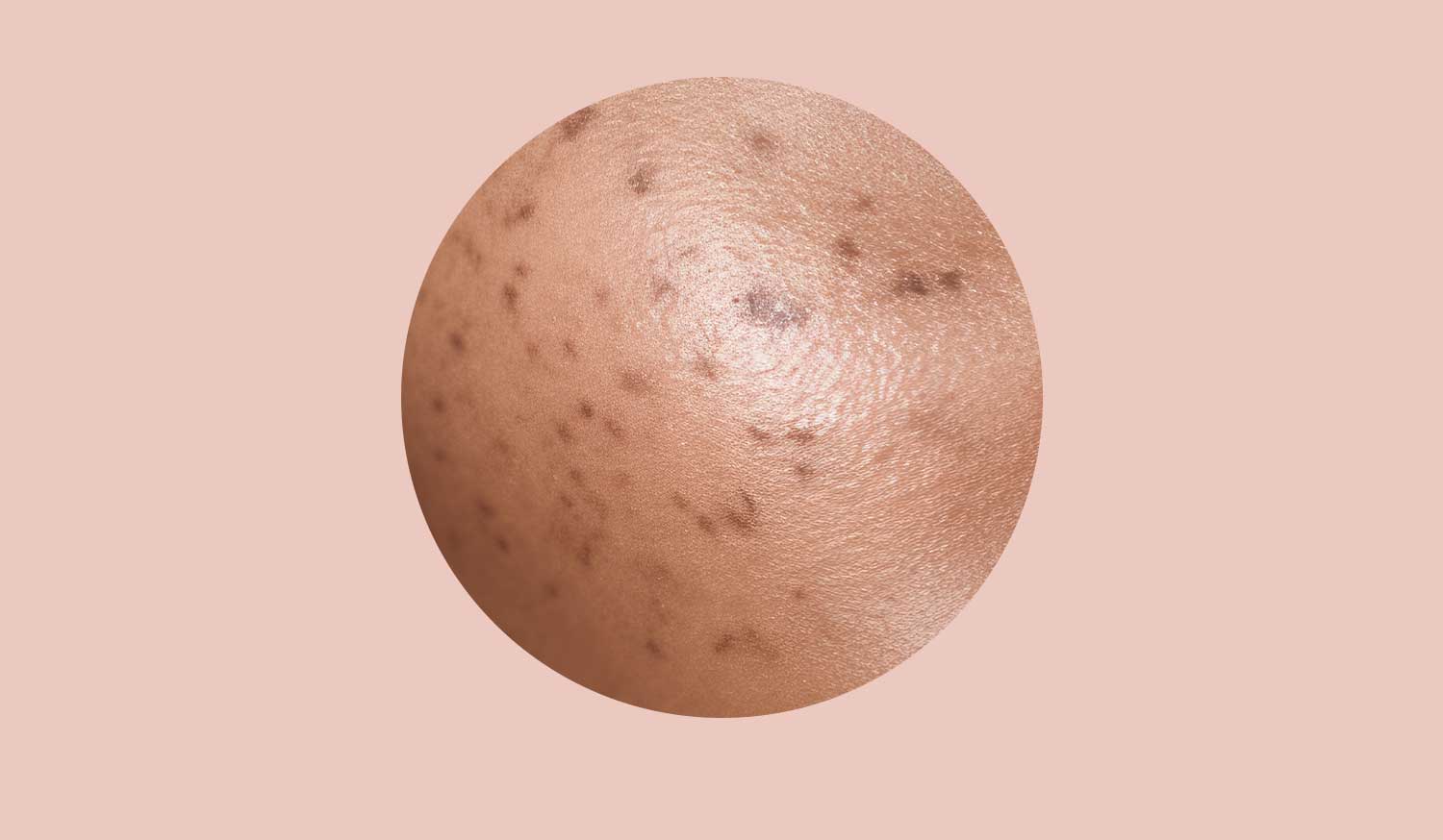 Skin Lightening Dark Spots