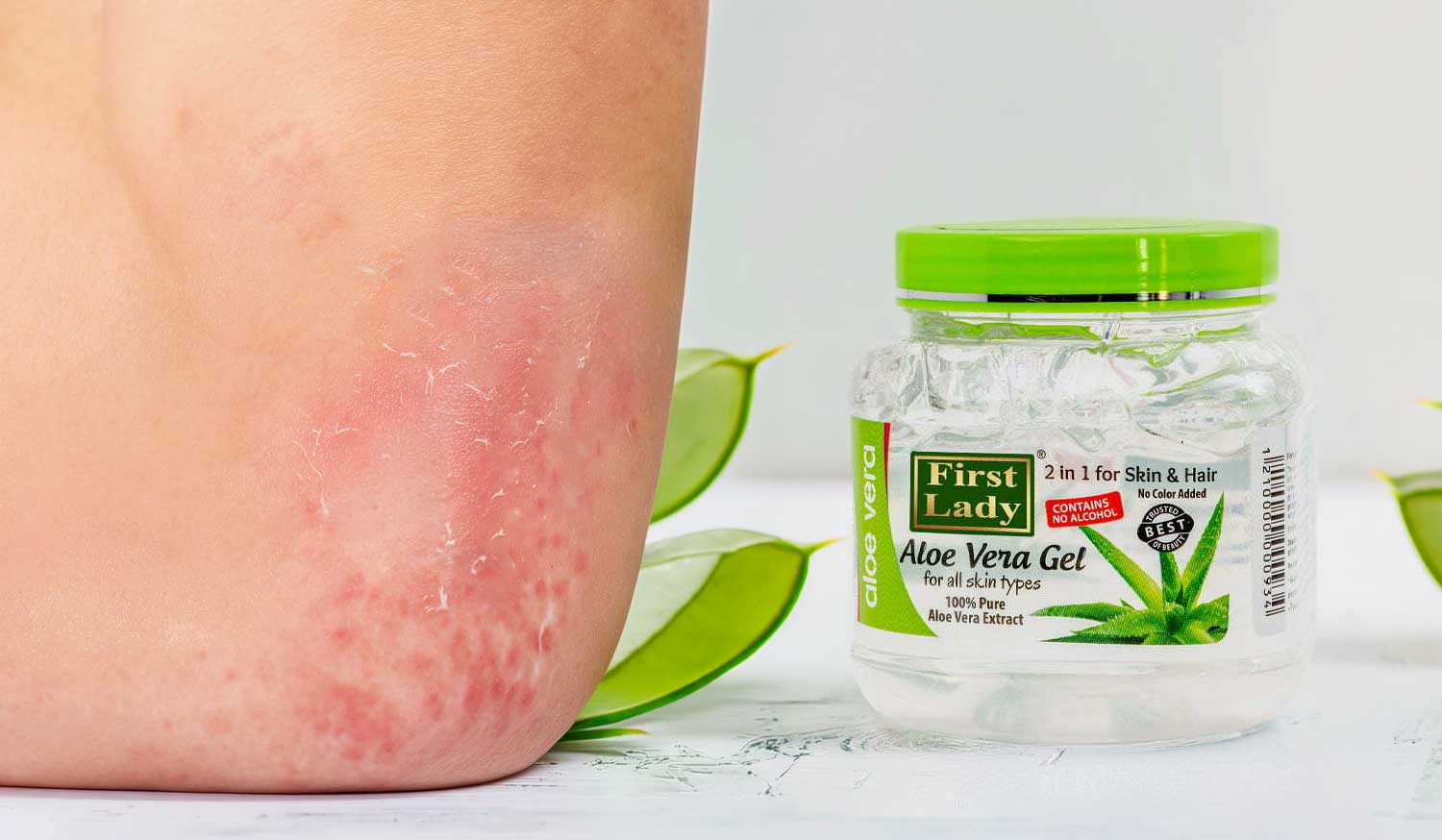 Why First Lady’s Aloe Vera Gel Is the Ultimate After Sun Skincare Essential