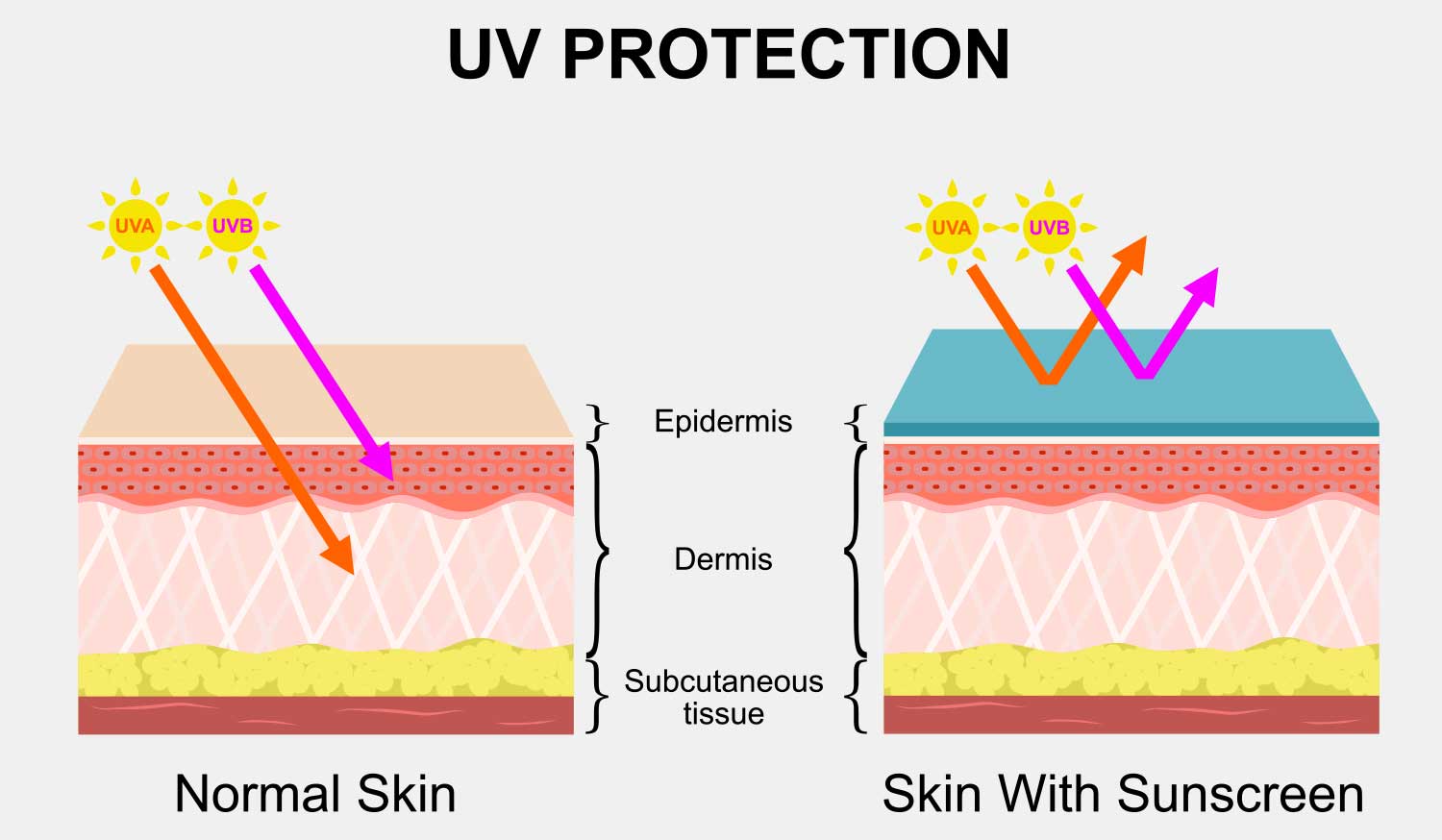 Why Your Dark Spots Keep Returning Despite A Good Skin Care Regime